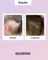 Glowwa Meno - Afbeelding 7