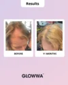 Glowwa Meno - Afbeelding 6